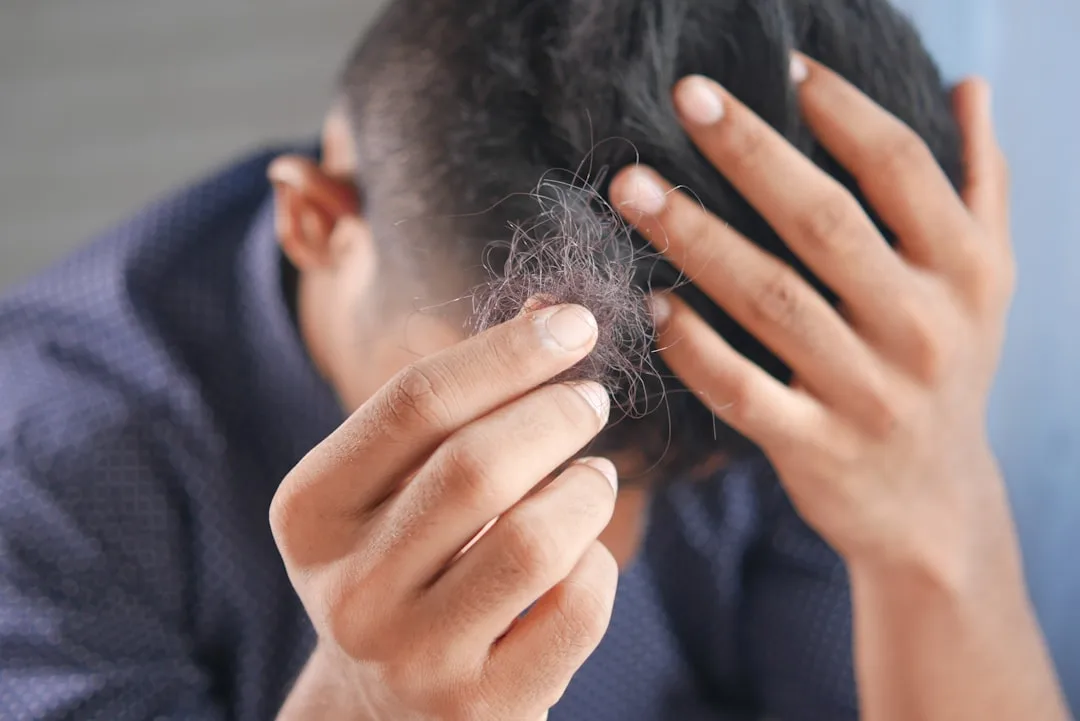Cuir chevelu dix jours après une greffe de cheveux avec petits greffons visibles et légère rougeur